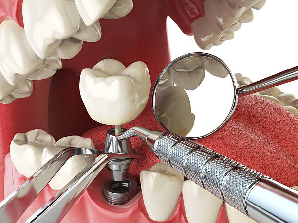 Best Pediatric Emergency Dentist in Sleepy Hollow, IL